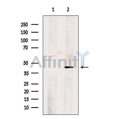 FOXQ1 Antibody -DF13639