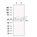 Asporin Antibody -DF13642