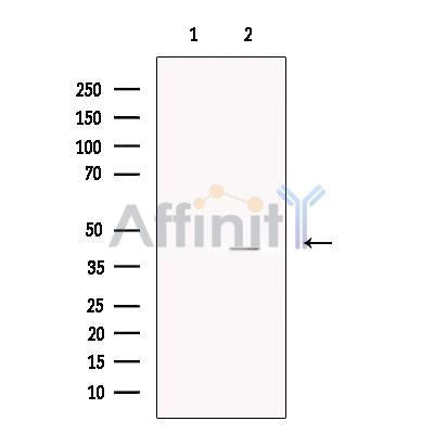 Asporin Antibody -DF13642