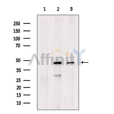 SLC1A5 Antibody -DF13643