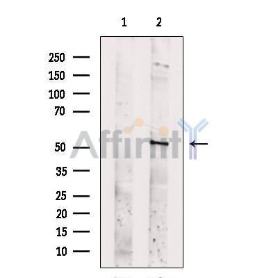 SLC16A8 Antibody -DF13644