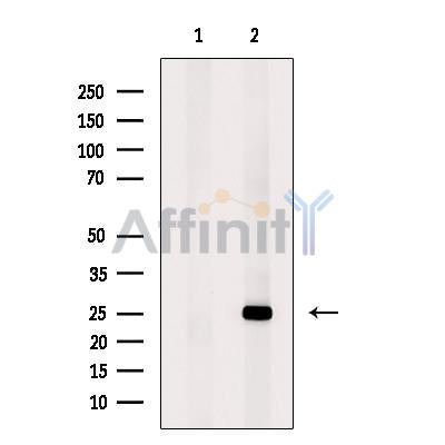 MIS12 Antibody -DF13646