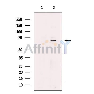 GLUT12 Antibody -DF13649