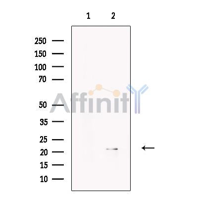 Apolipoprotein M Antibody -DF13650