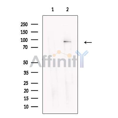 Glycogen synthase 2 Antibody -DF13655