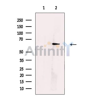 Glucose 6 phosphate isomerase Antibody -DF13660