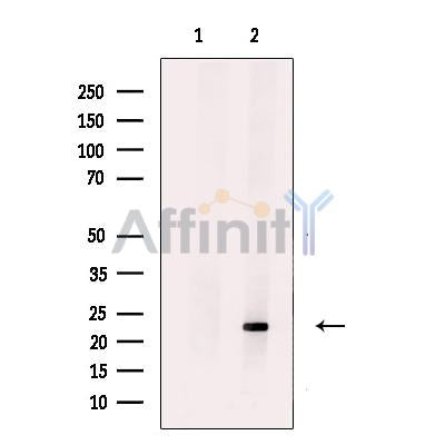 HB EGF Antibody -DF13666