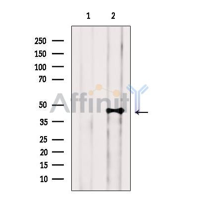 DLST Antibody -DF13671