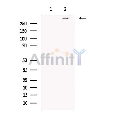 TACC2 Antibody -DF13674