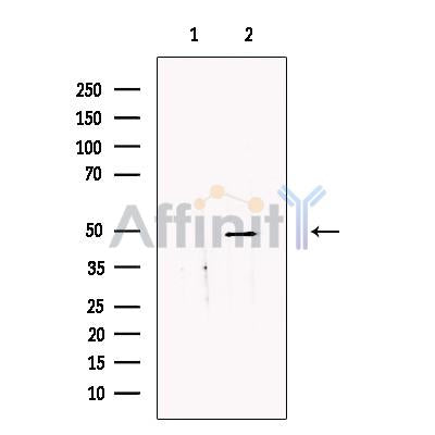 SDCCAG3 Antibody -DF13676