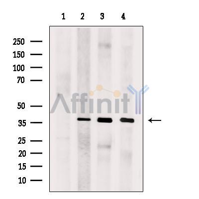 SUCLG1 Antibody -DF13677