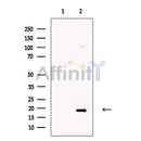 Olfactory Marker Protein Antibody -DF13678