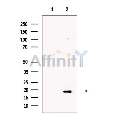 Olfactory Marker Protein Antibody -DF13678