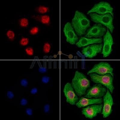 Importin 7 Antibody -DF13679