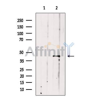 VPS36 Antibody -DF13682