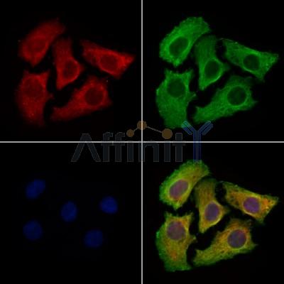 UNC5B Antibody -DF13685