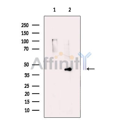 AADACL1 Antibody -DF13688