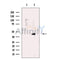 AADACL1 Antibody -DF13688