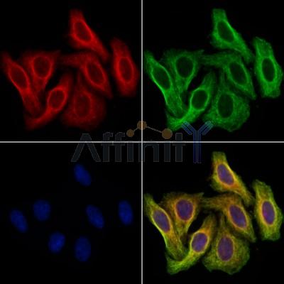 TCP1 beta Antibody -DF13690