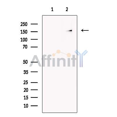 KIAA0701 Antibody -DF13691