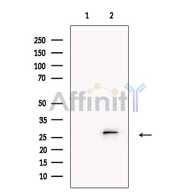 TMEM109 Antibody -DF13695