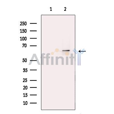 PRMT4 Antibody -DF13699