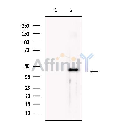 Snx6 Antibody -DF13700
