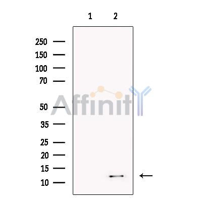 Kappa light chain Antibody -DF13703