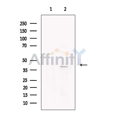 p40 Antibody -DF13704