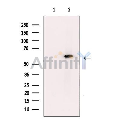 TBX5 Antibody -DF13705