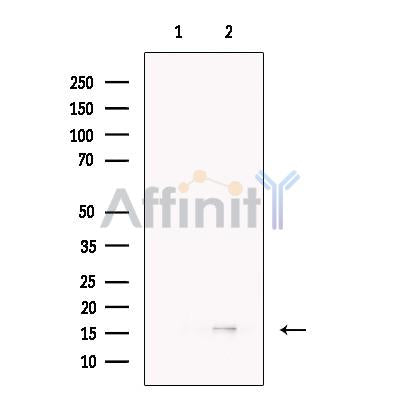 TCTEX1D2 Antibody -DF13706