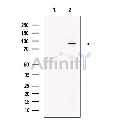 Pyrin Antibody -DF13708