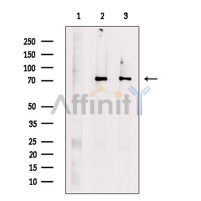 Methylmalonyl Coenzyme A mutase Antibody -DF13718