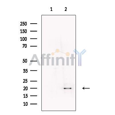 UXT Antibody -DF13721