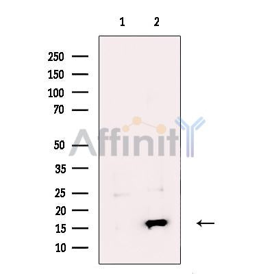 CST2 Antibody -DF13725