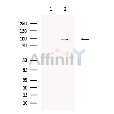 TTC7A Antibody -DF13728