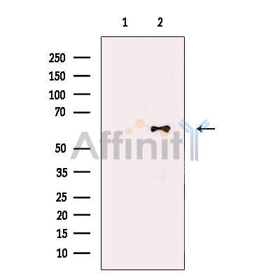 IL21 Receptor Antibody -DF13734