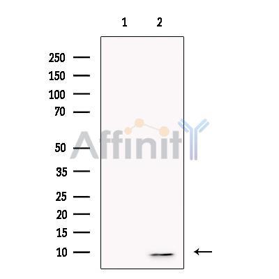 Thymosin beta 10 Antibody -DF13736