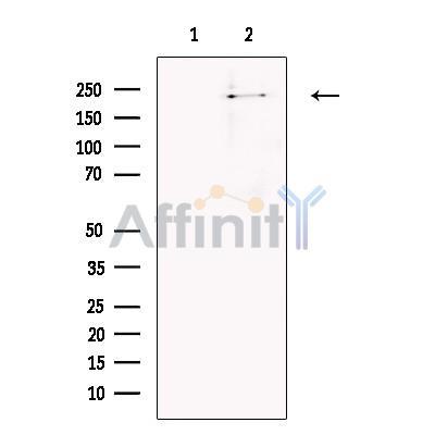 SorLA Antibody -DF13742