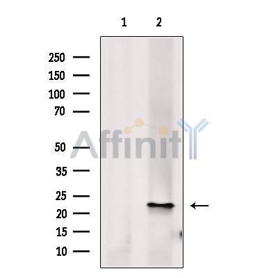 Histone H1.1 Antibody -DF13743