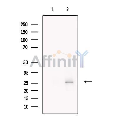 SPC25 Antibody -DF13747