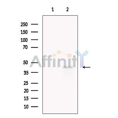 LHX6 Antibody -DF13749