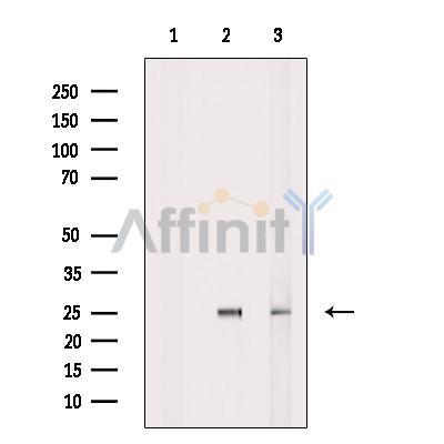 Claudin 17 Antibody -DF13751