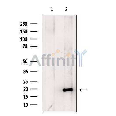 Hippocalcin Antibody -DF13752