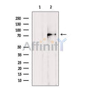 DF2330 at 1/100 staining RAT testis tissue by IHC-P. The sample was formaldehyde fixed and a heat mediated antigen retrieval step in citrate buffer was performed. The sample was then blocked and incubated with the antibody for 1.5 hours at 22¡ãC. An HRP conjugated goat anti-rabbit antibody was used as the secondary
