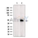 DF2331 at 1/100 staining  testis tissue by IHC-P. The sample was formaldehyde fixed and a heat mediated antigen retrieval step in citrate buffer was performed. The sample was then blocked and incubated with the antibody for 1.5 hours at 22¡ãC. An HRP conjugated goat anti-rabbit antibody was used as the secondary