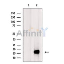 Western blot analysis of LPPL expression in HEK293 cells ,The lane on the left is treated with the antigen-specific peptide.