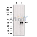 Western blot analysis of EBP2 expression in NCI-H292 cell line lysates ,The lane on the left is treated with the antigen-specific peptide.