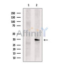 Western blot analysis of TSSC4 expression in HEK293 cells ,The lane on the left is treated with the antigen-specific peptide.