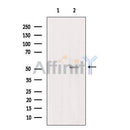 Western blot analysis of ORC5 expression in  Human fetal brain lysate;,The lane on the left is treated with the antigen-specific peptide.